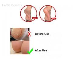 Easy Aid Of Heel Pain